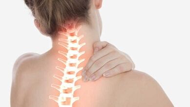 De belangrijkste manifestaties van cervicale osteochondrose