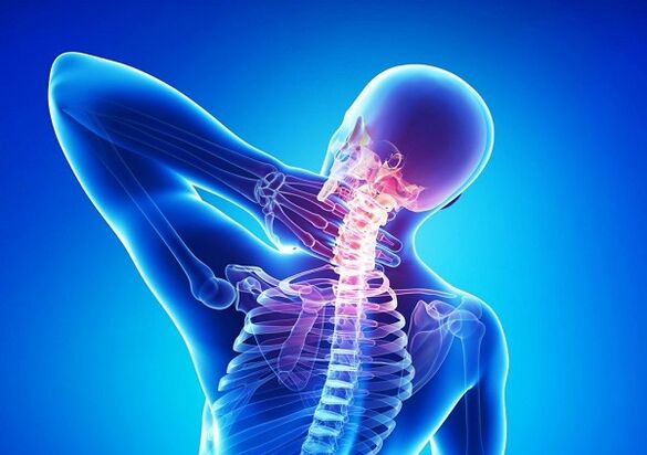 Pijn in de cervicale wervelkolom met osteochondrose