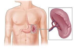 pathologie van de milt als oorzaak van pijn onder het linkerschouderblad