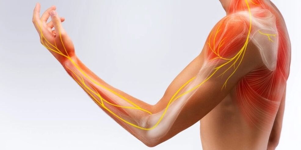 Pijn en gevoelloosheid van de vingers duiden op schade aan de ligamenten als gevolg van stenoserende ligamentitis
