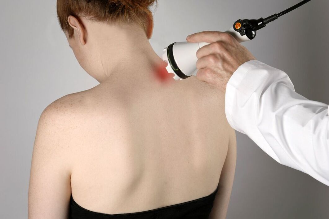fysiotherapeutische behandeling van cervicale osteochondrose